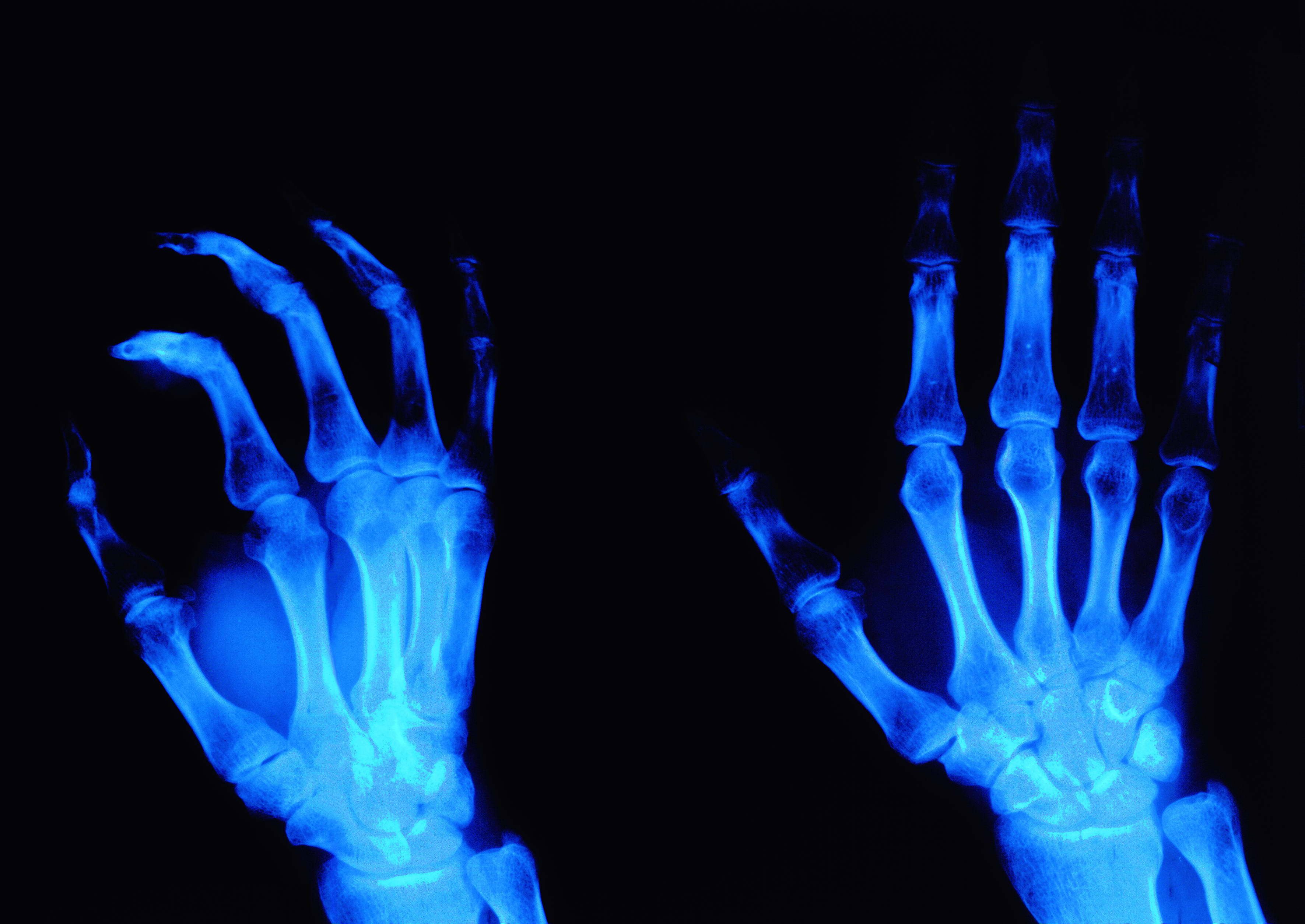 MoFPI1626844974xray_texture2553.jpg